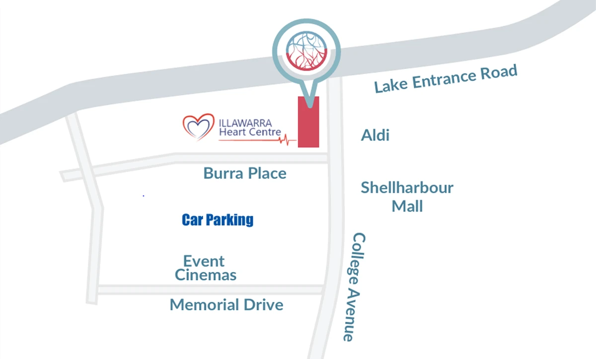 Circulation Health Shellharbour map