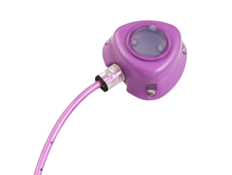 Photo of hand palms that are shining from excessive sweat