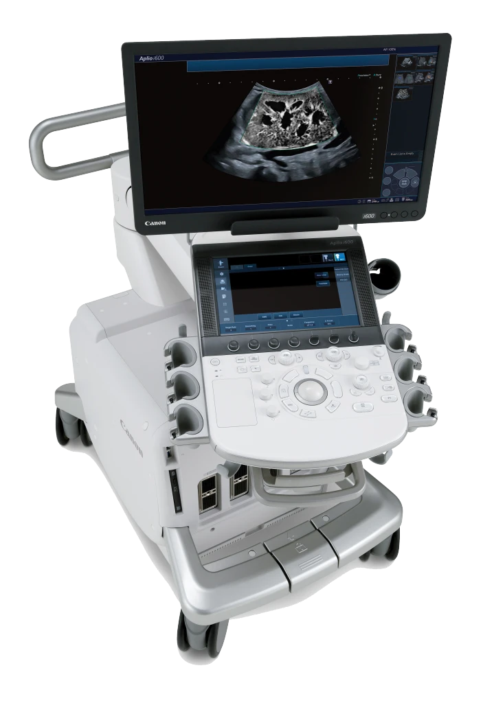 Photo of hand palms that are shining from excessive sweat